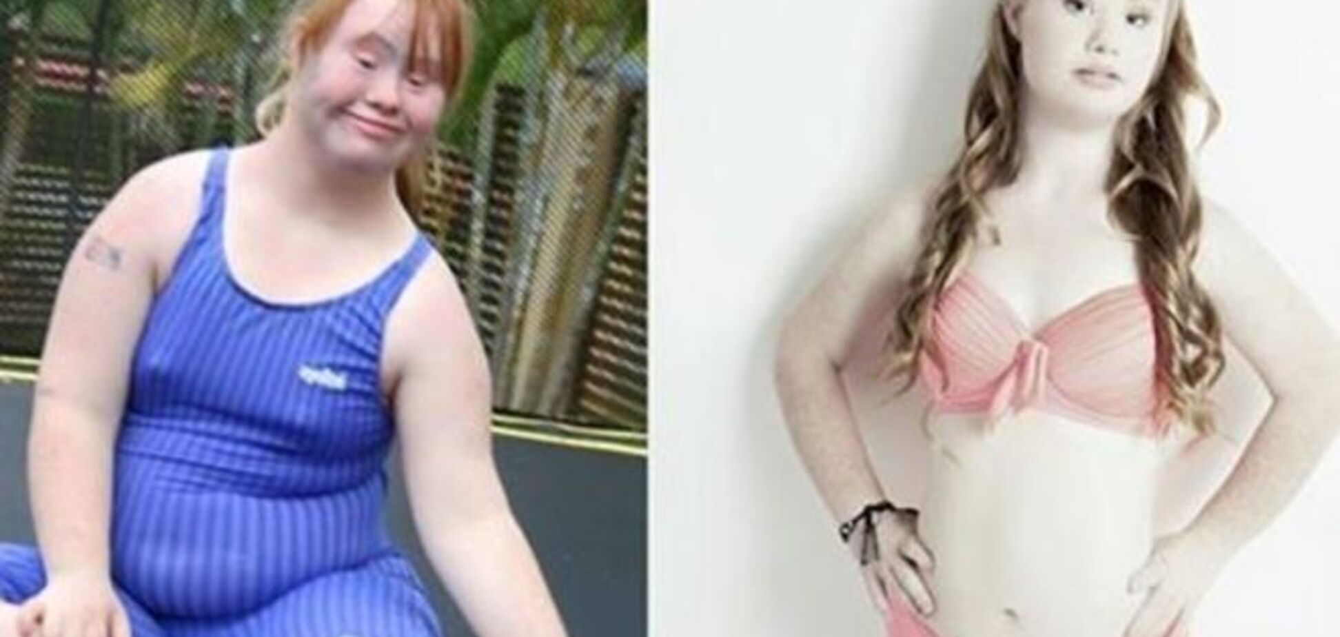 Невероятное перевоплощение: девушка с синдромом Дауна стала красавицей-моделью 