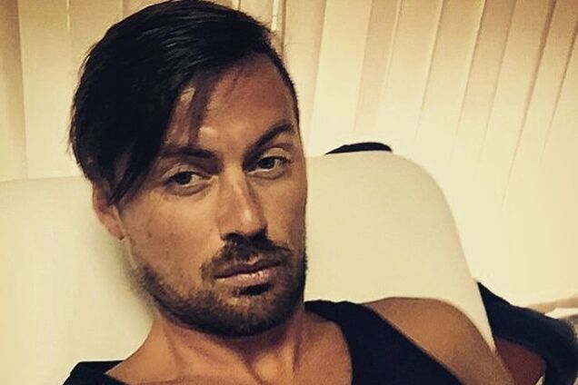 'На больничном'. Обгоревший Милевский напугал фанатов: фотофакт