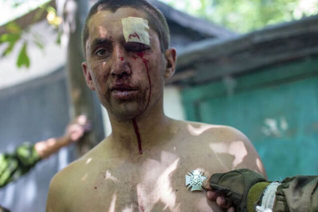 Amnesty International: и украинская сторона, и террористы пытают пленных