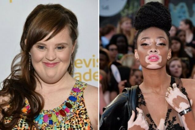 10 женщин, которые доказали, что у красоты нет границ