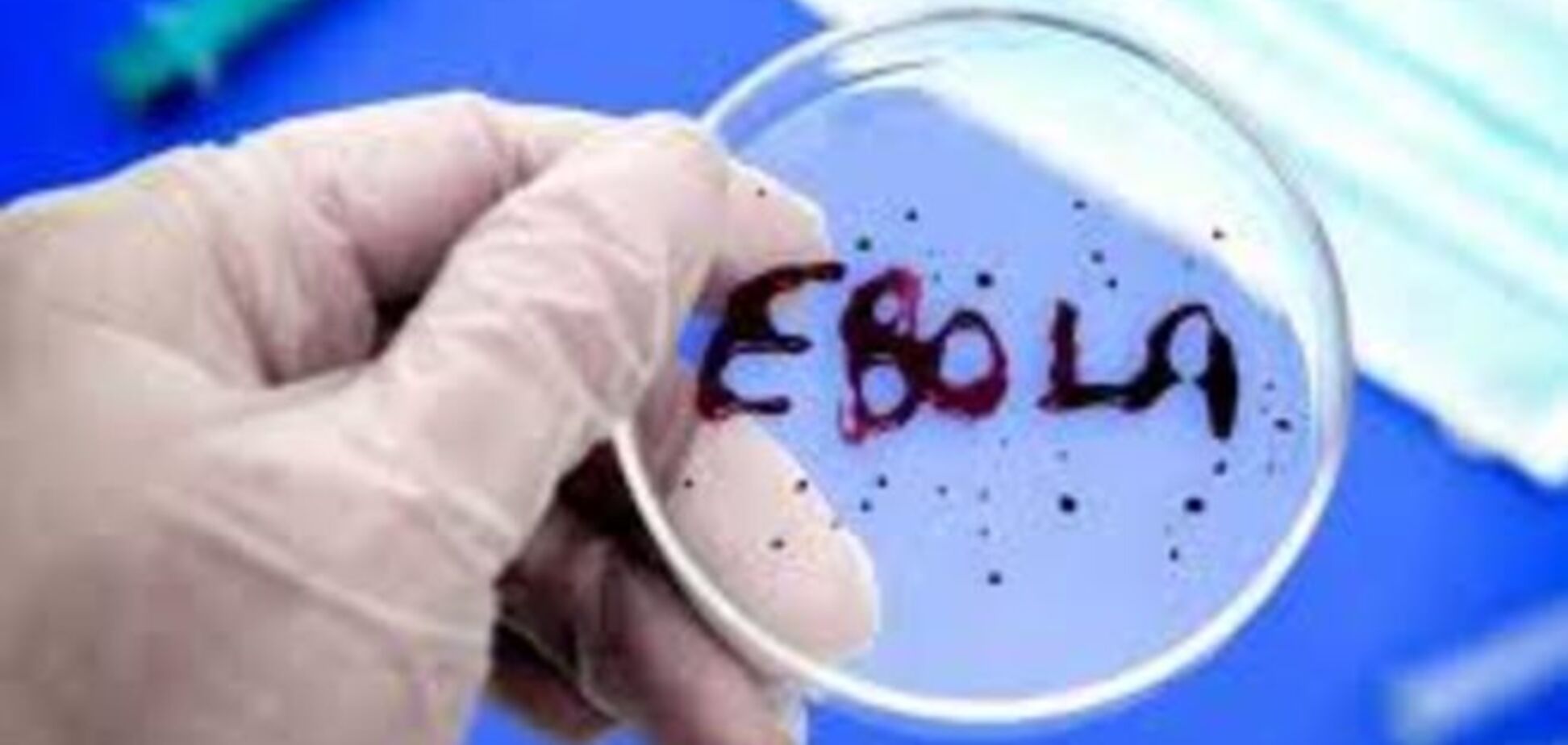 На пути к исцелению: ученые нашли слабое место у вируса Эбола