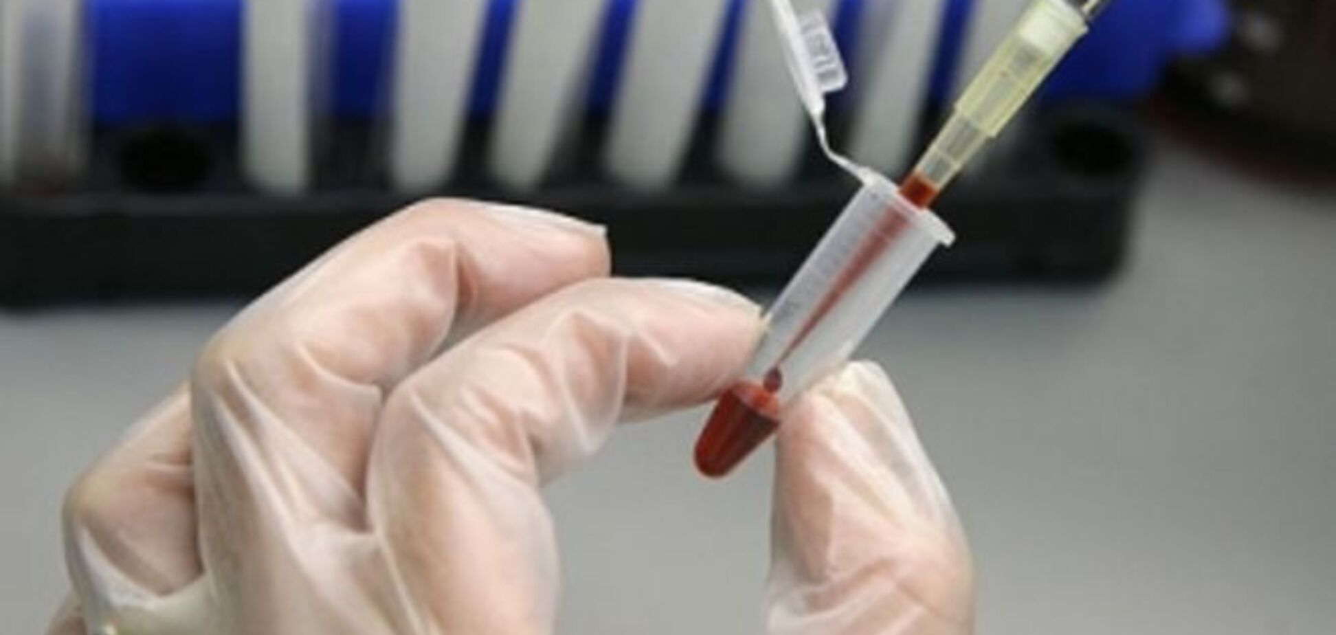 Ученые смогли заблокировать размножение ВИЧ у человека