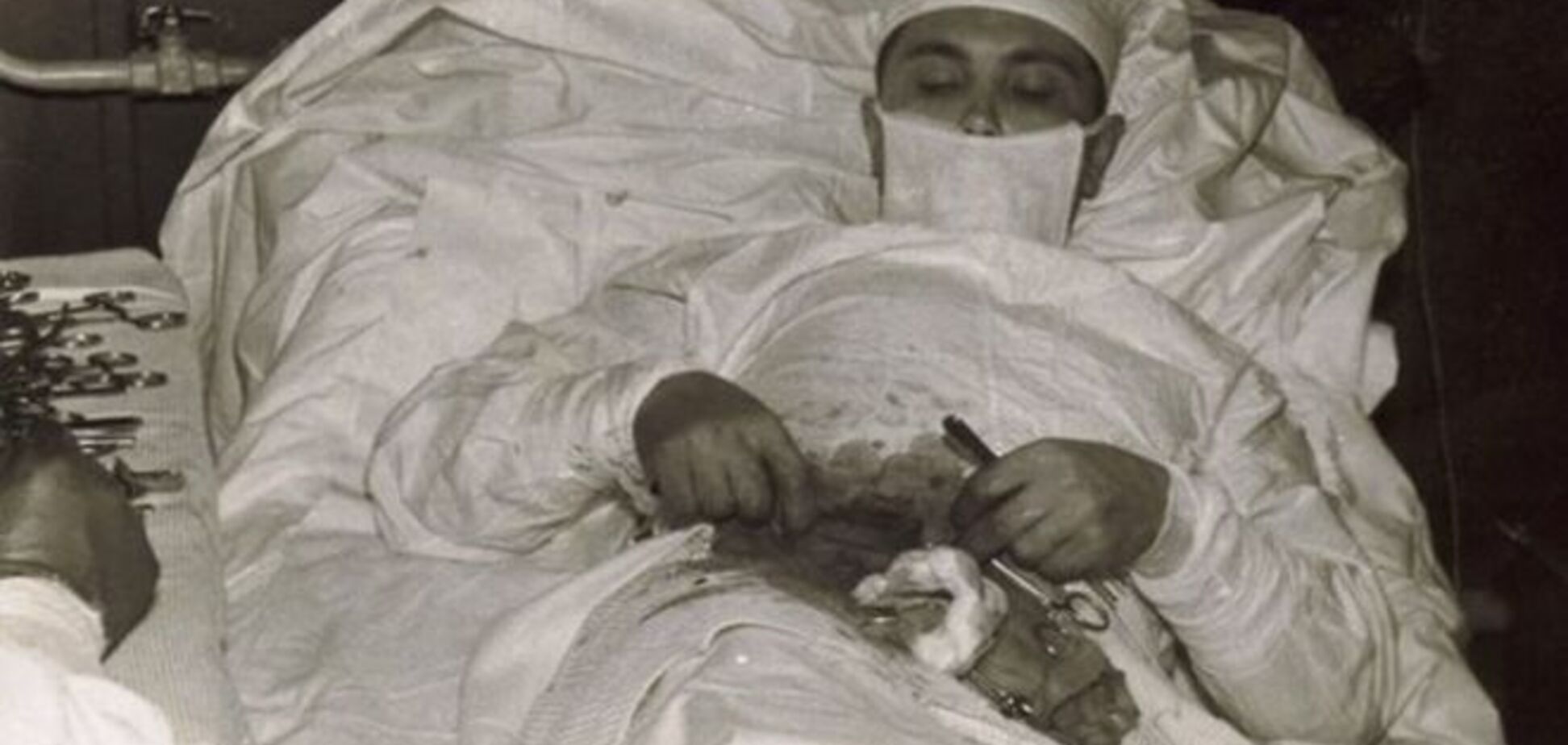 Круче, чем Хаус. Невероятная история советского хирурга, который сам себе удалил аппендикс
