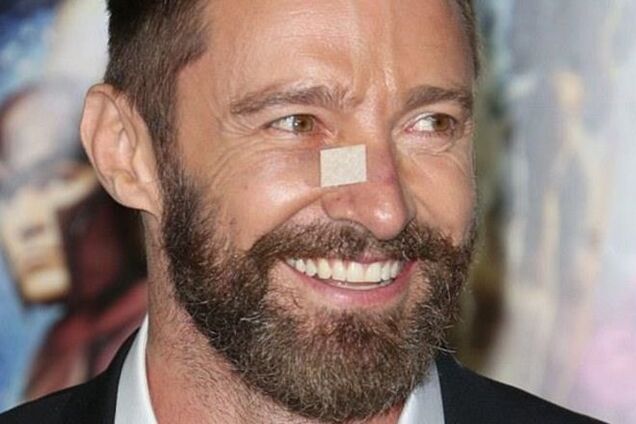 У Хью Джекмана за полтора года 4 раза находили рак