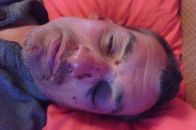 Выдворенный из Украины Ташбаев заявил, что его жестоко избили