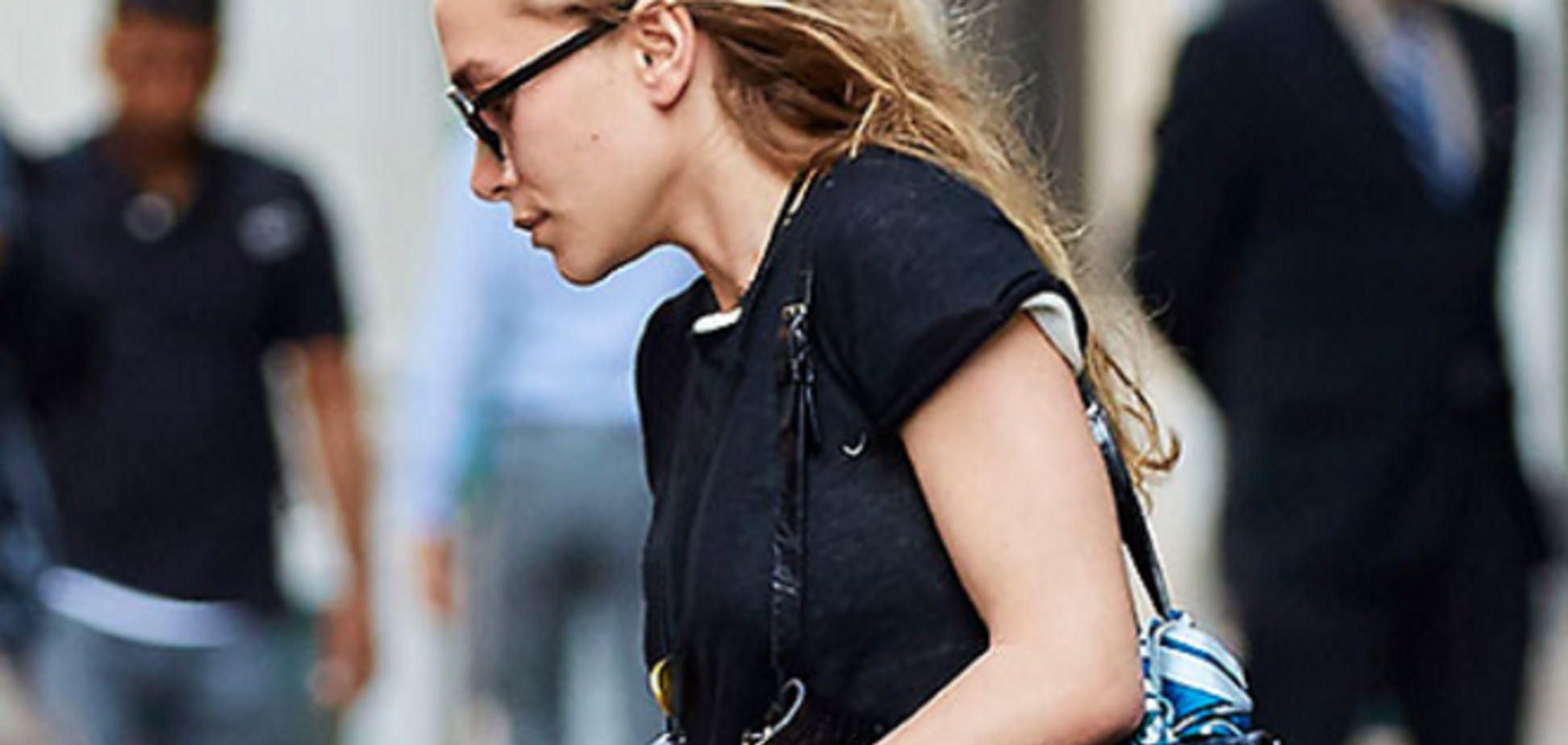 28-летняя Эшли Олсен начала терять волосы