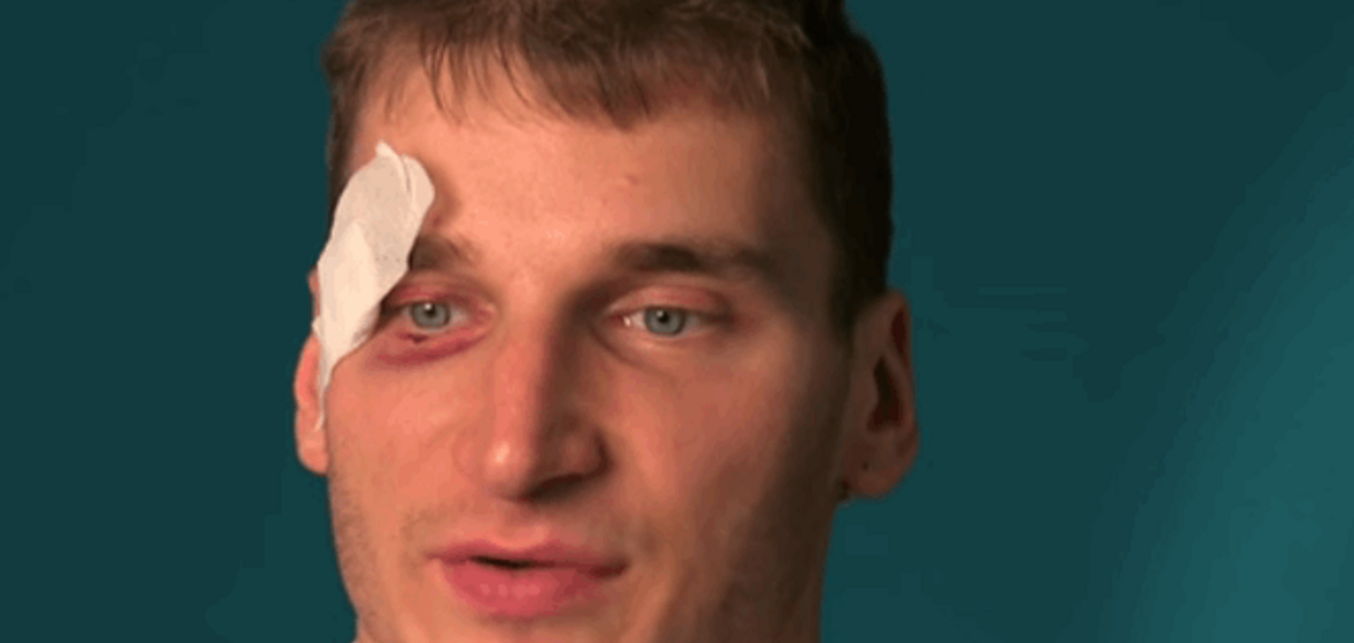 В 'ДНР' сдали нервы: журналист рассказал, кто стоит за его избиением