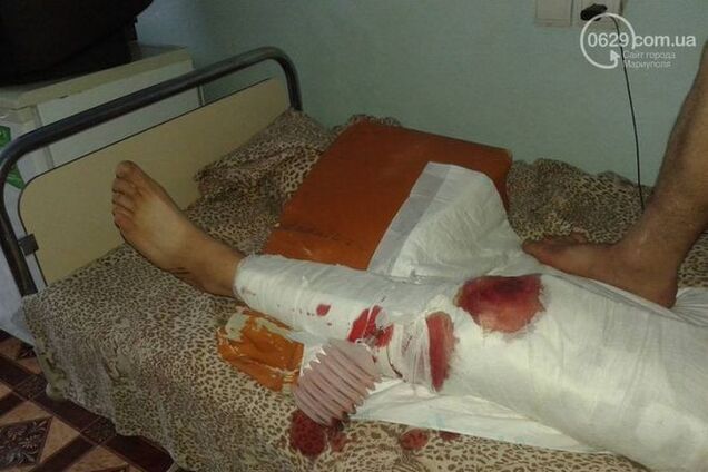 Під Маріуполем снайпер застрелив бійця АТО, ще двоє поранені