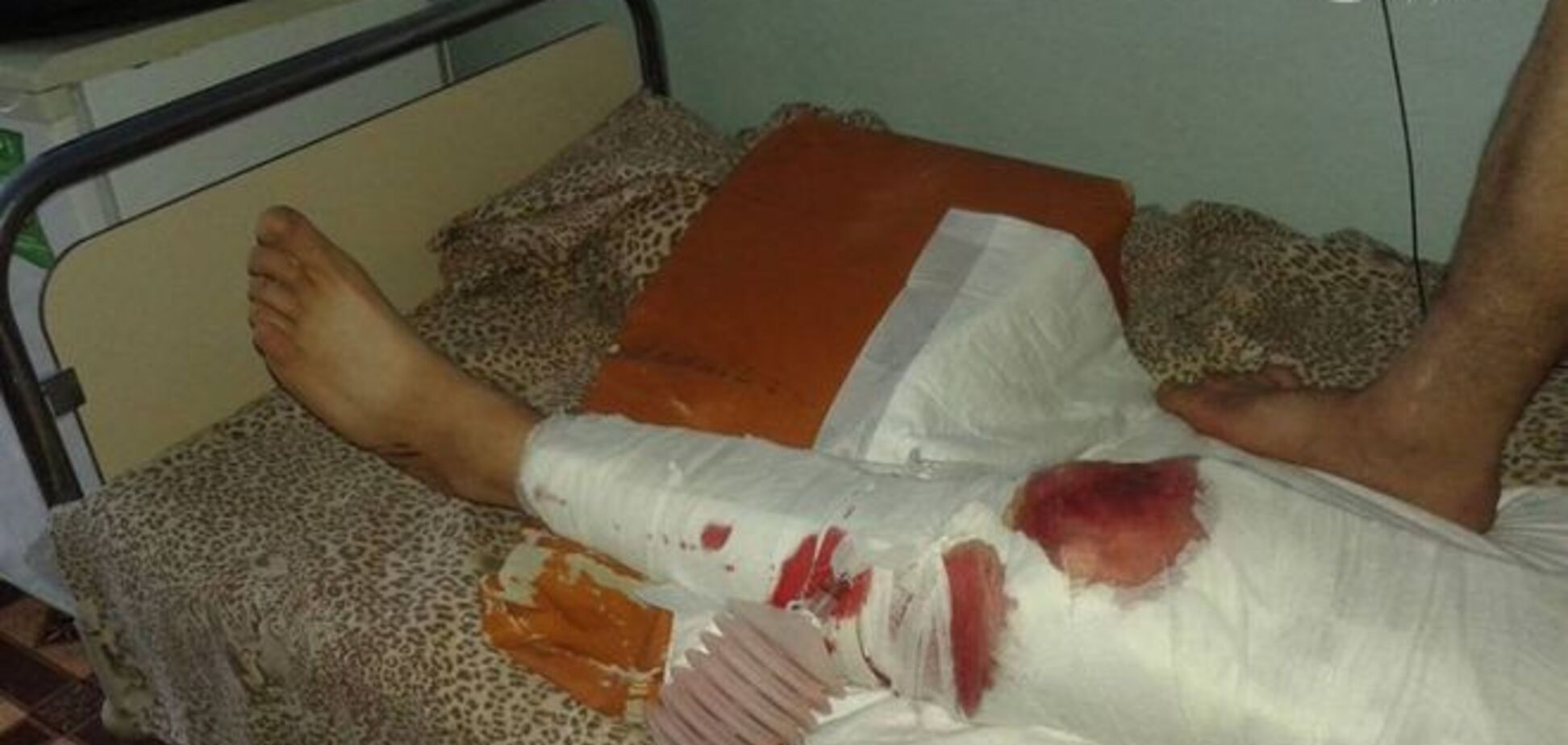 Под Мариуполем снайпер застрелил бойца АТО, еще двое ранены