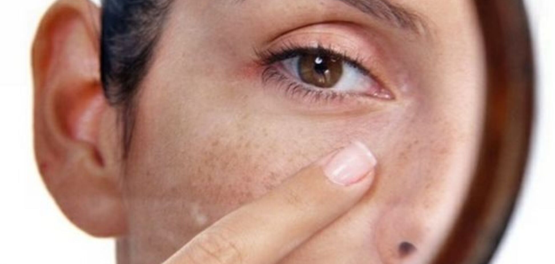 8 рецептов, которые сотрут с лица пигментные пятна