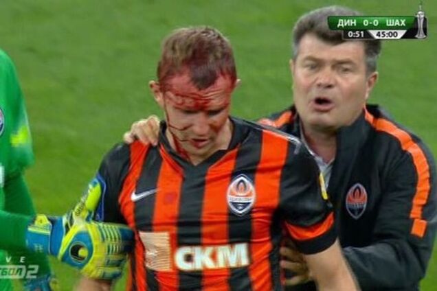 Футболисту 'Шахтера' разбили голову в финале Кубка Украины: кровавые фото