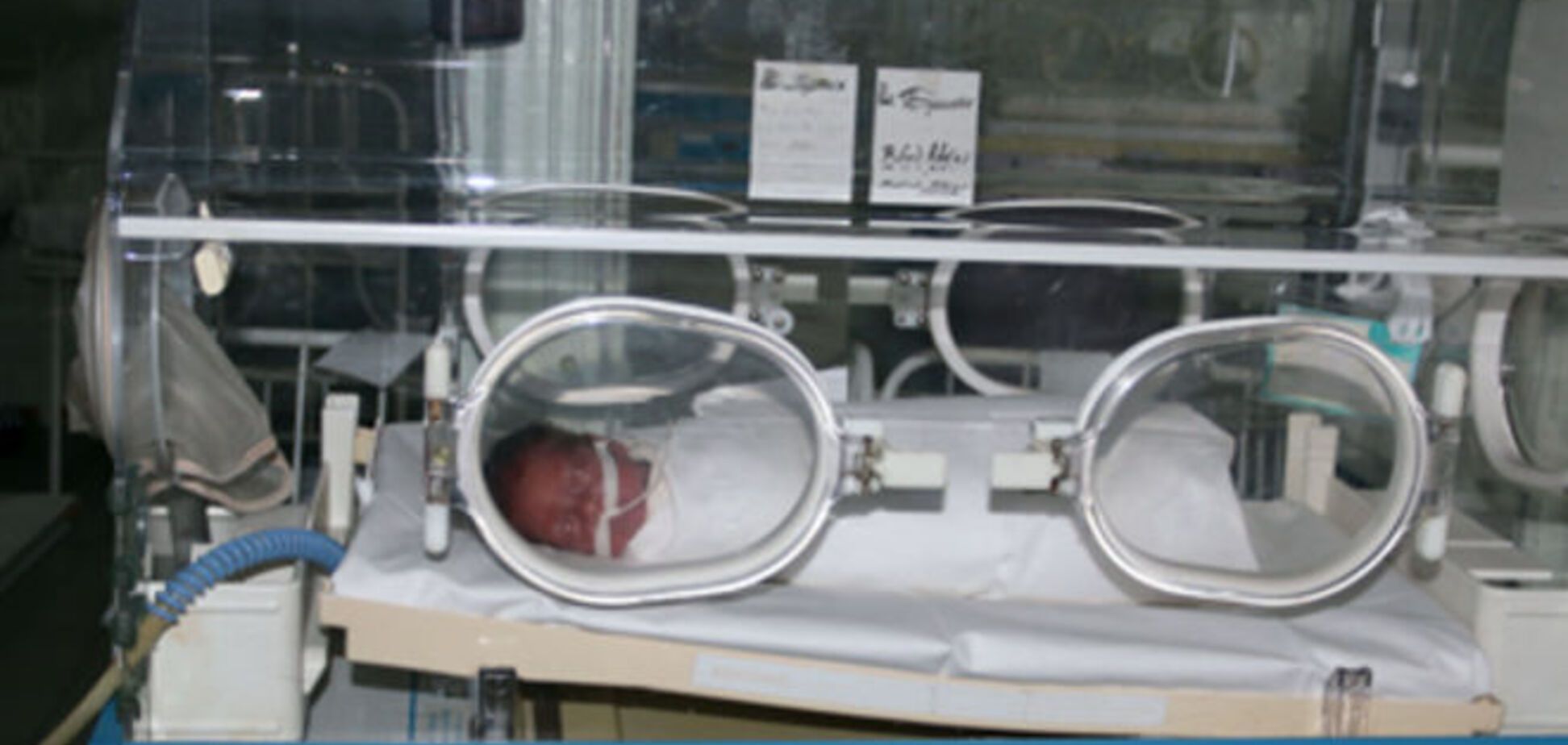 У Маріуполі 7-місячну дитину заморили голодом: фотофакт