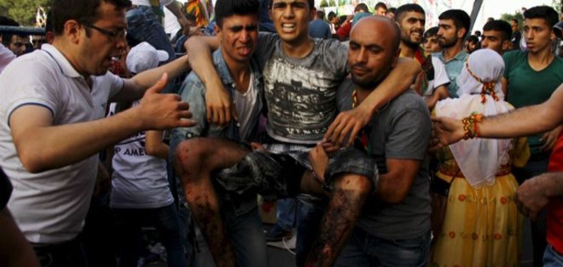 Теракт в Турции: из-за взрывов на митинге двое погибли, более 150 раненых