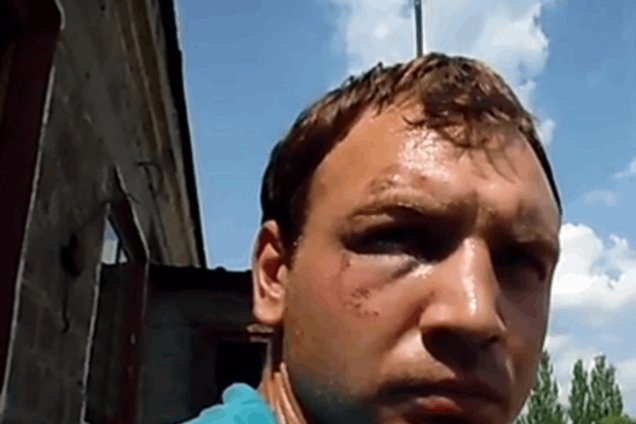 Террористы заставили пленного бойца АТО соврать о наступлении и 200 погибших под Марьинкой: видеодоказетельство