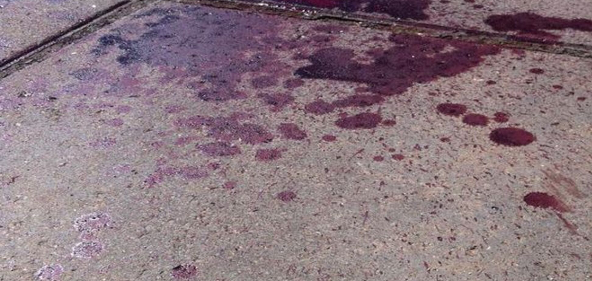 Милиция назвала число пострадавших на гей-прайде в Киеве