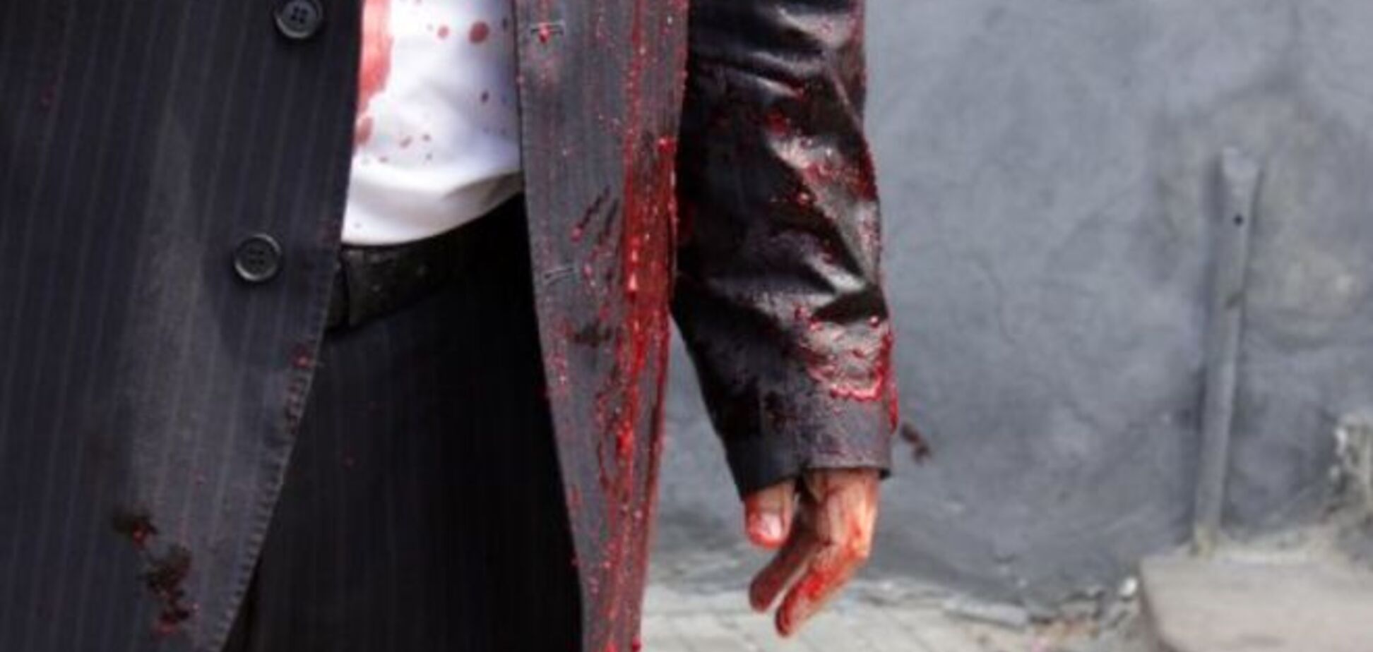 Во Львове нардепа из 'Оппозиционного блока' облили свиной кровью: опубликованы фото и видео