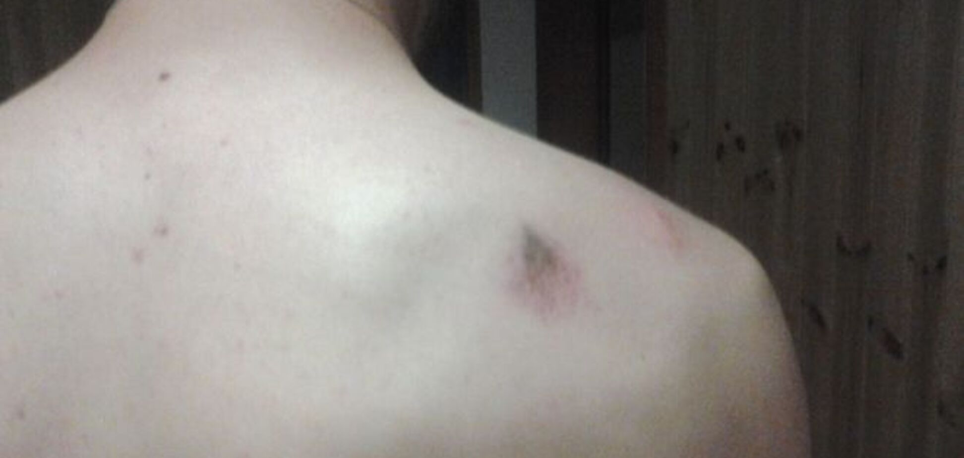 Киевлянин попал в плен прямо во время прогулки: подробности