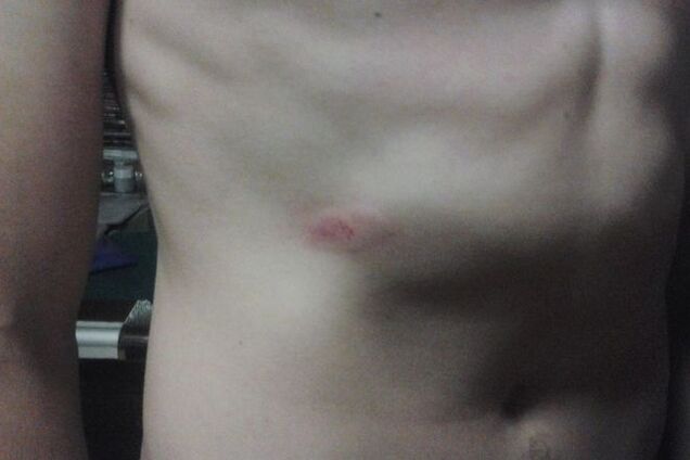 В Киеве избили парня: перепутали с вором