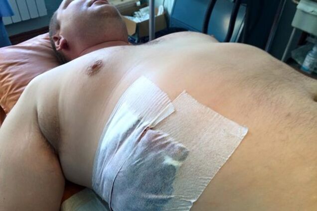 Раненого в АТО Булатова отправили в Киев: экс-министр поделился жуткими фото с операции