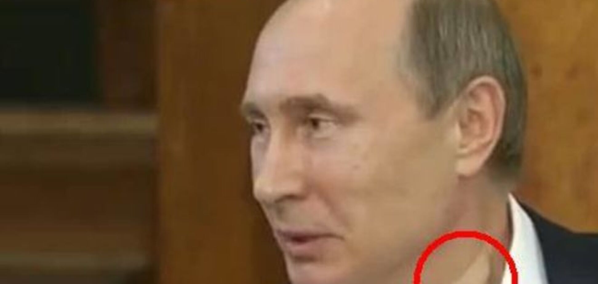 Его вампир покусал: соцсети о Путине с пластырем на шее