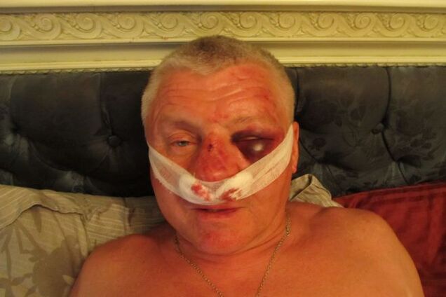 В Запорожье похитили и избили одного из лидеров 'Правого сектора'