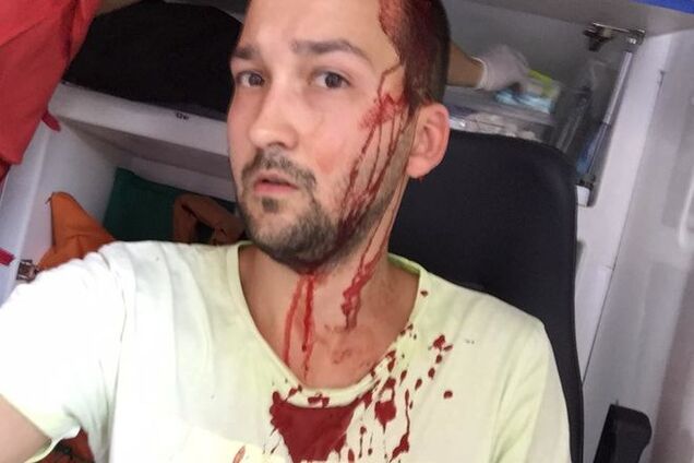 В Киеве громила на внедорожнике битой избил велосипедиста. Фотофакт