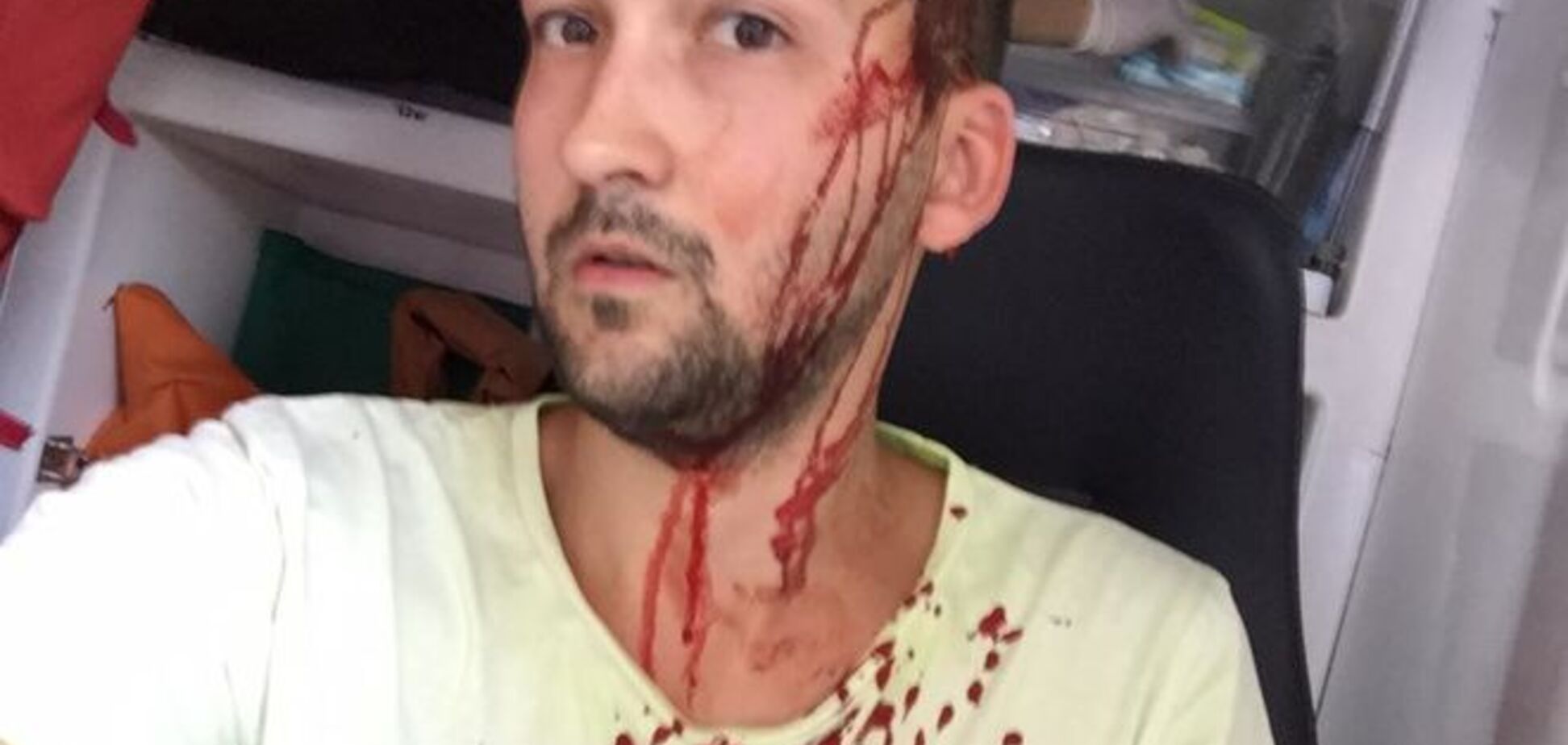 В Киеве громила на внедорожнике битой избил велосипедиста. Фотофакт