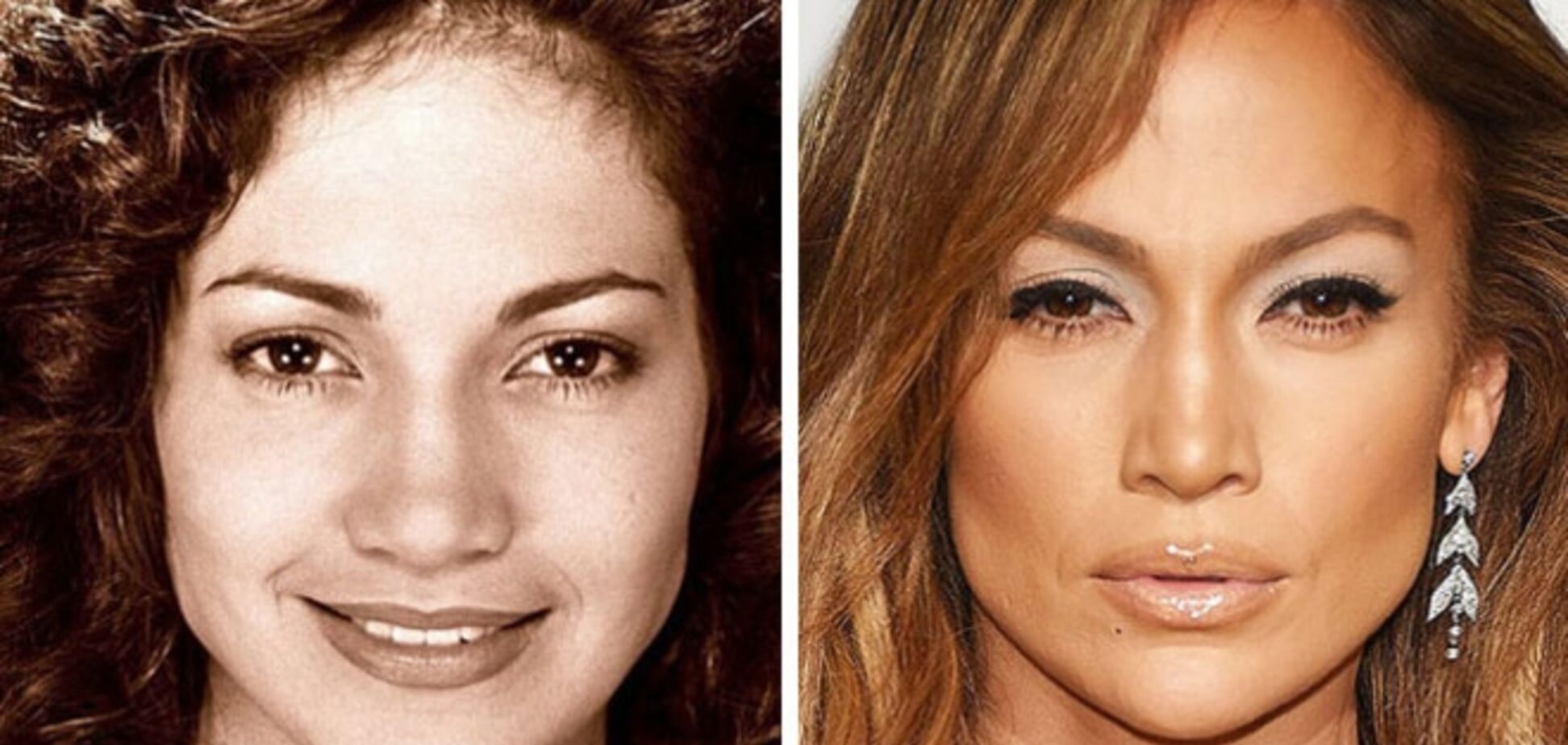 Самые красивые подправленные носы знаменитостей: фотоподборка