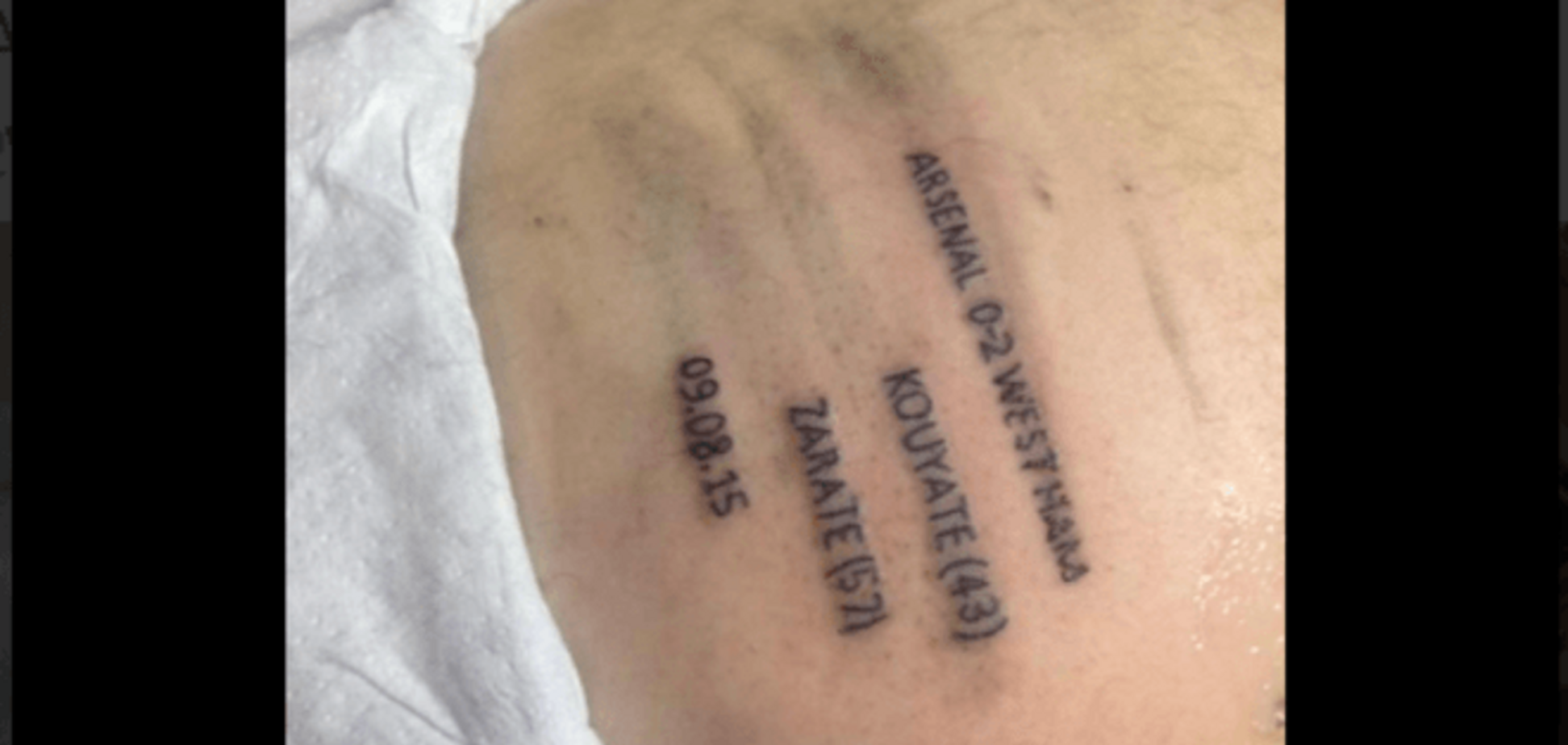 Английский фанат увековечил на заднице результат любимого клуба