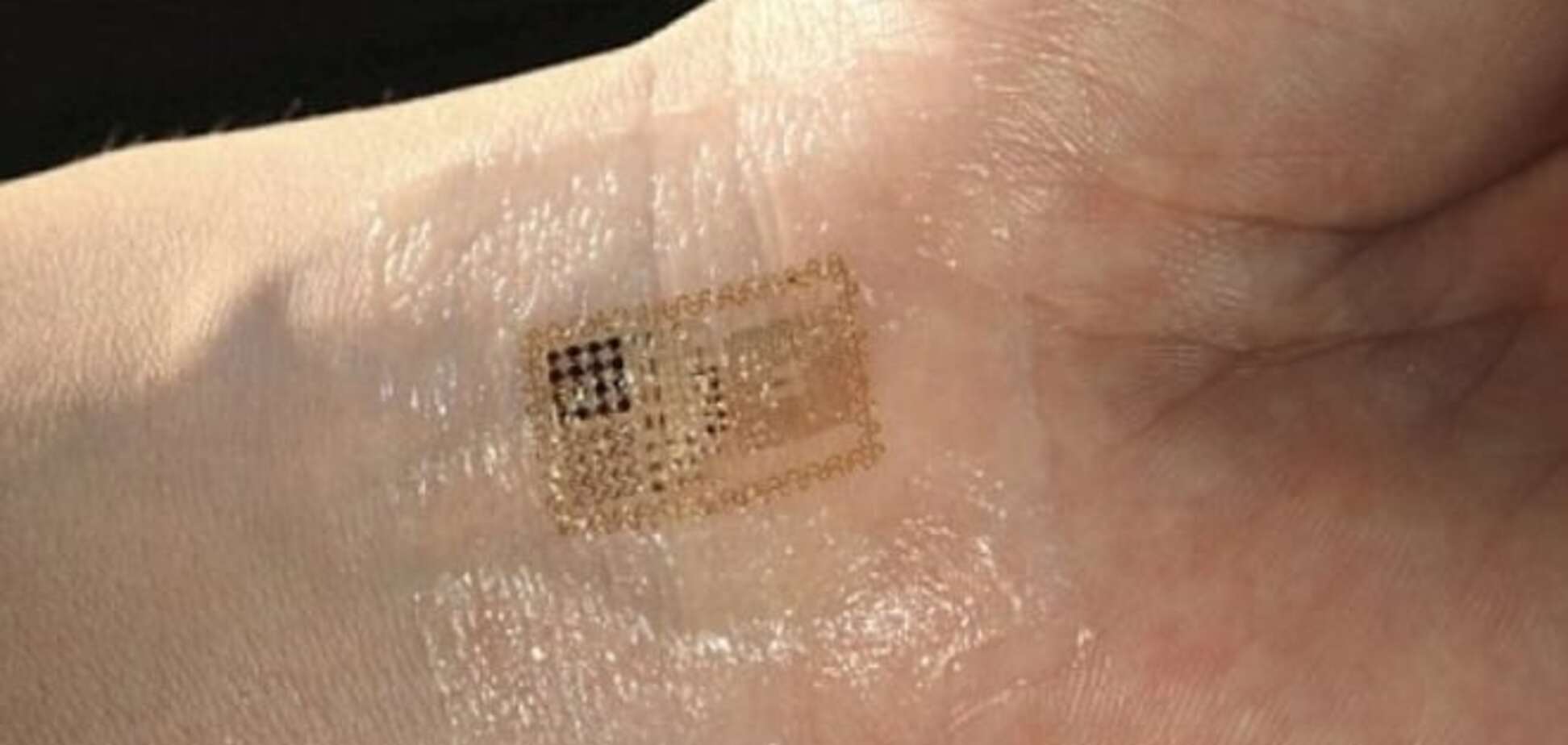 Как переселенцам в Украине чипы вшивают