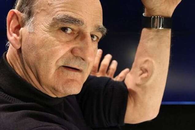 В Австралии 'чокнутый профессор' пришил к руке ухо с Wi-Fi