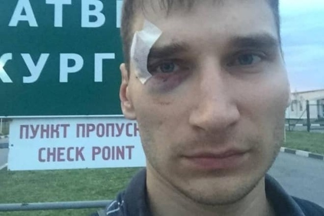 Следком РФ простил террористам 'ДНР' избиение российского журналиста