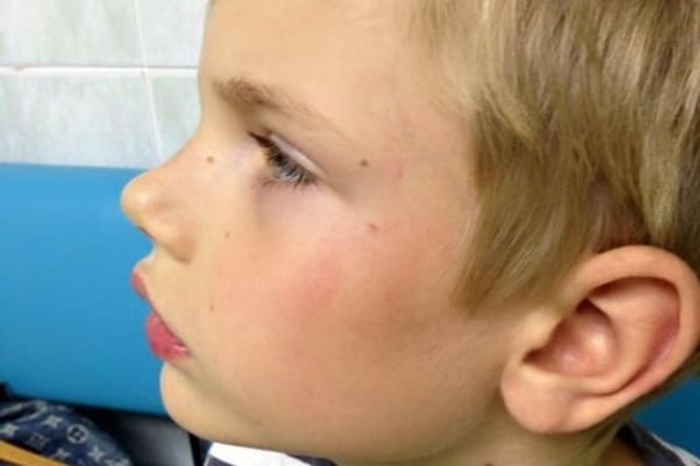 'Чтоб не кричал': в Киеве врач-травматолог ударил ребенка-инвалида по лицу