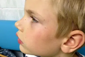 Ребенка ударил по лицу врач