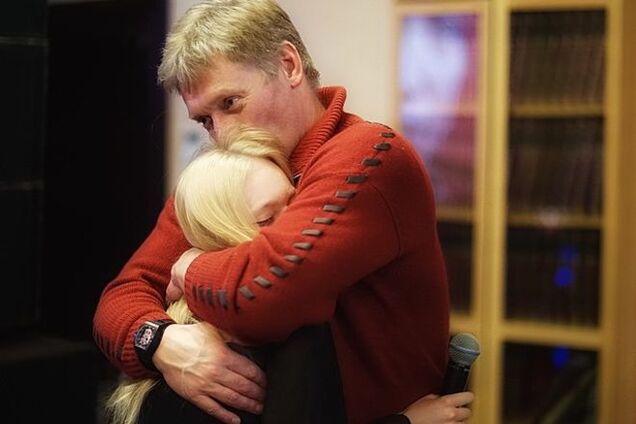 Навальный уличил пресс-секретаря Путина во лжи о часах: фотофакт