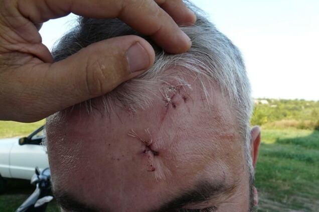 На Черкасщине пьяный пономарь храма УПЦ МП попытался зарезать священника