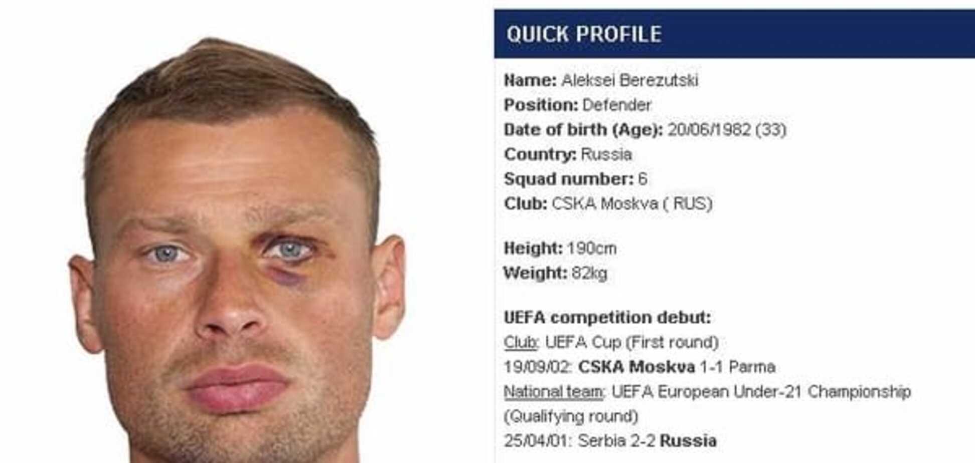 'Лицо России': московский футболист стал посмешищем после фото для УЕФА