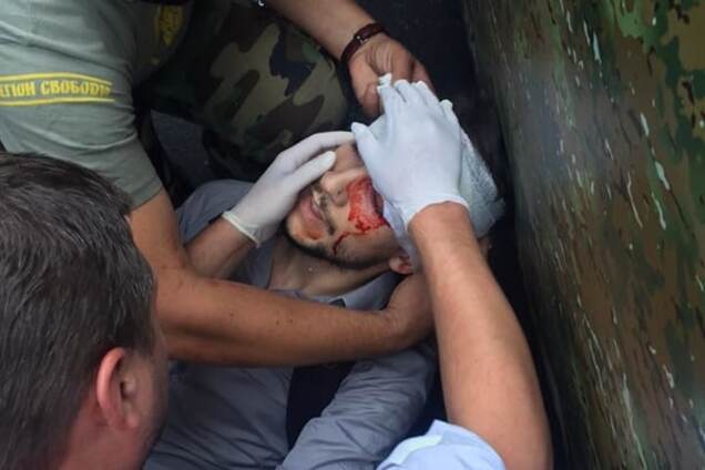 В столкновениях под Радой разбили голову французскому журналисту: фотофакт