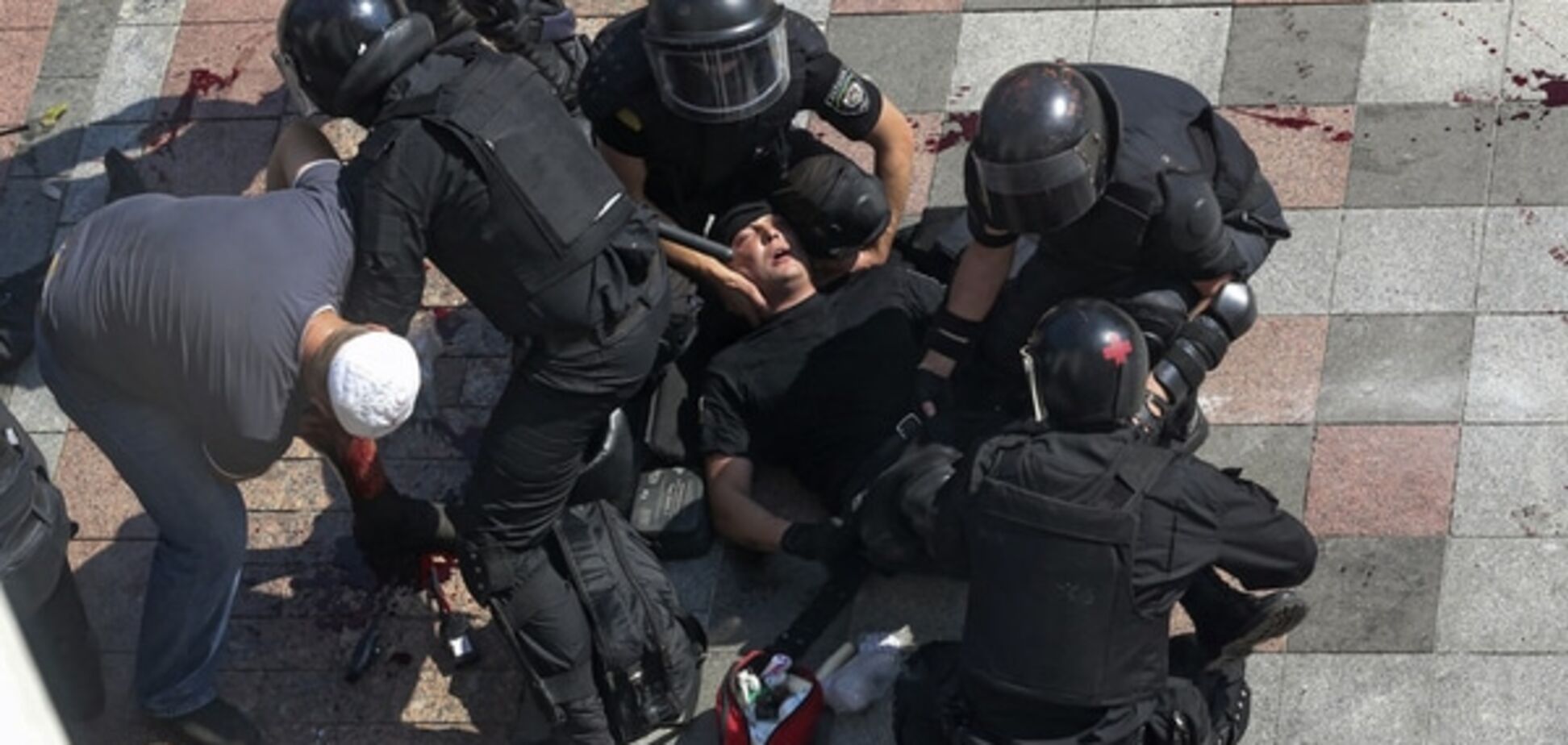 В столкновениях под Радой пострадали 125 человек - уточненные данные