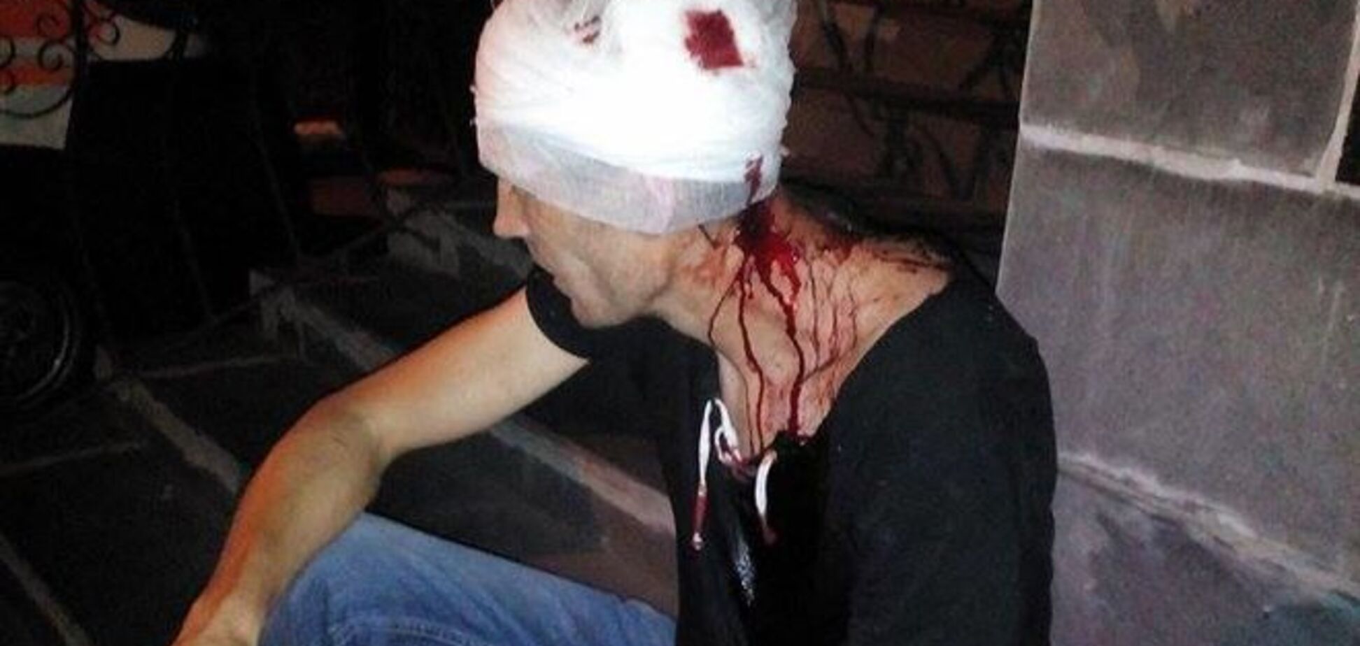 На Київщині жорстоко побили активіста 