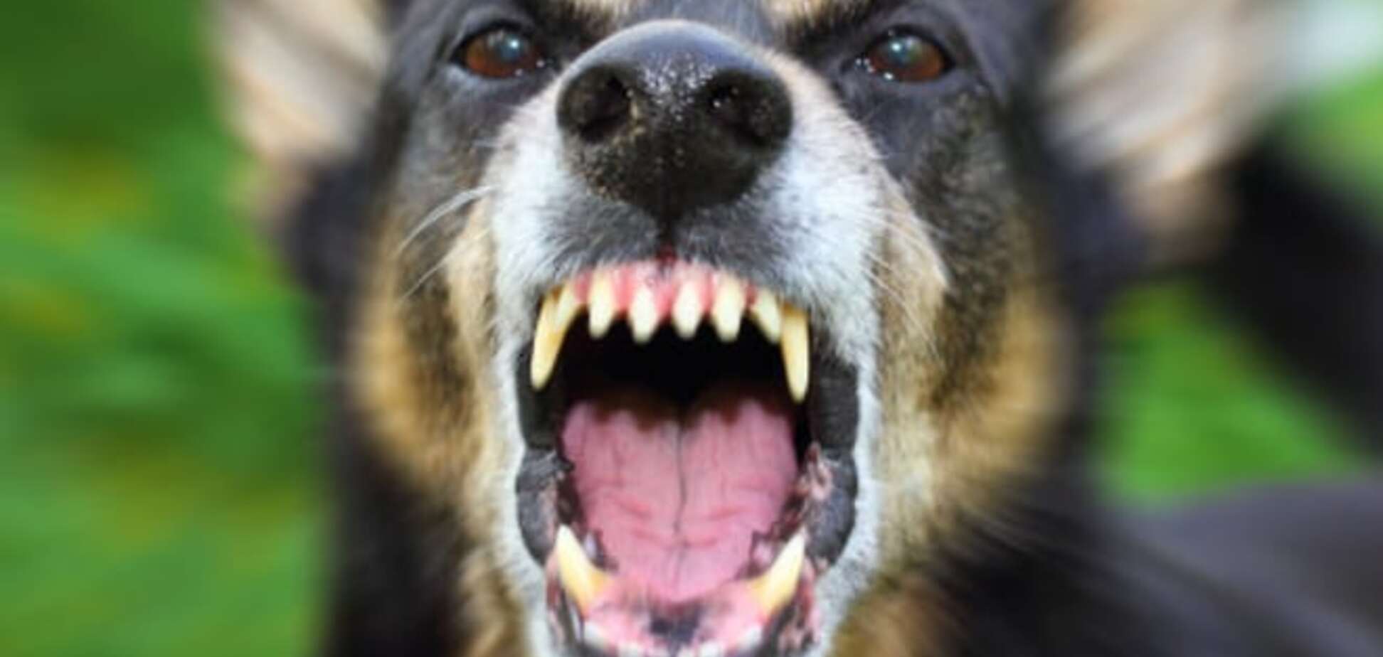 Выжить вопреки: на Киевщине искусанных бешеной собакой детей спасло чудо