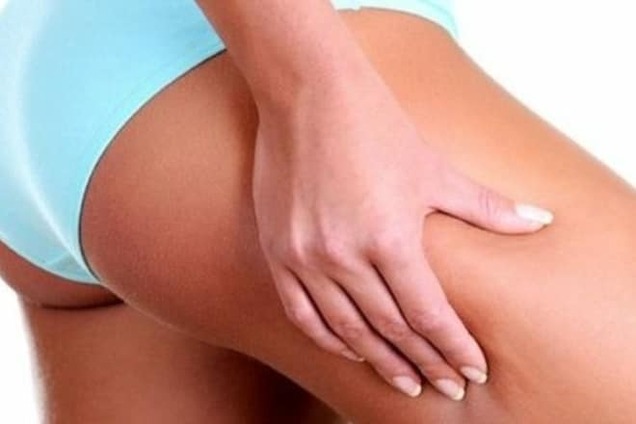 8 неожиданных причин целлюлита, о которых не знают женщины