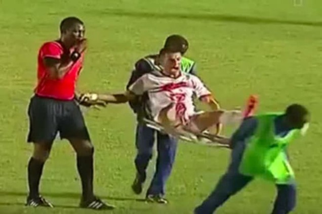 Африканские 'врачи-убийцы' сломали футболиста в Лиге чемпионов: видео инцидента