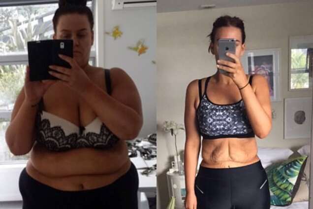 Мережу вразили фотографії дівчини, яка схудла за рік вдвічі: фотофакт