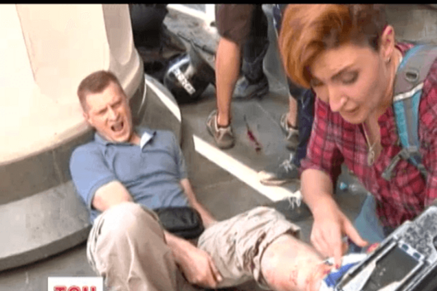 Из ноги раненого под Радой оператора не смогли вытащить осколок