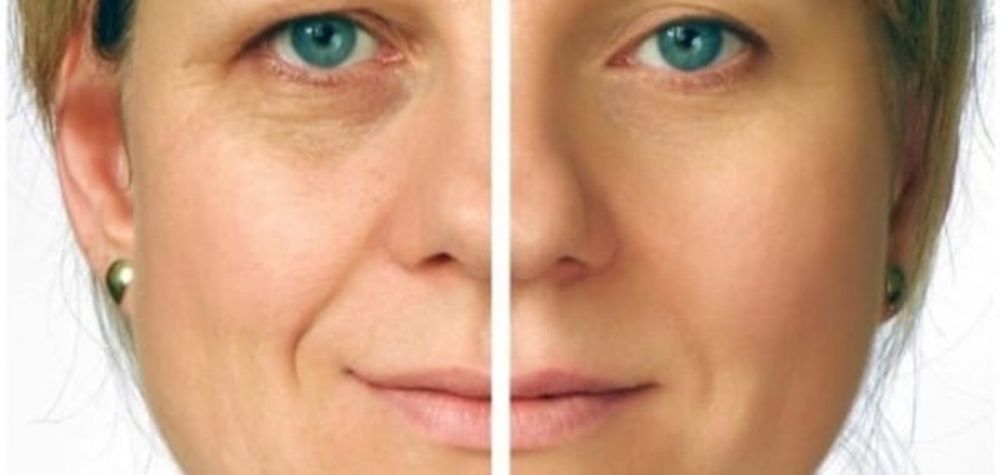 Уникальная методика омоложения лица: секрет Эммы Харди