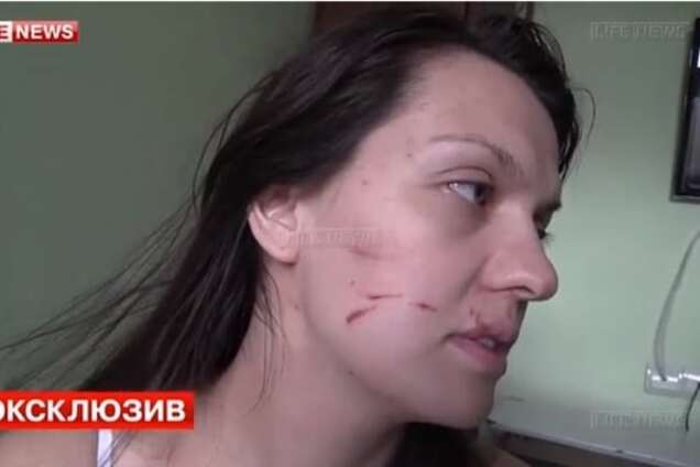 В Москве врач жестоко избила беременную беженку с Донбасса: видеофакт