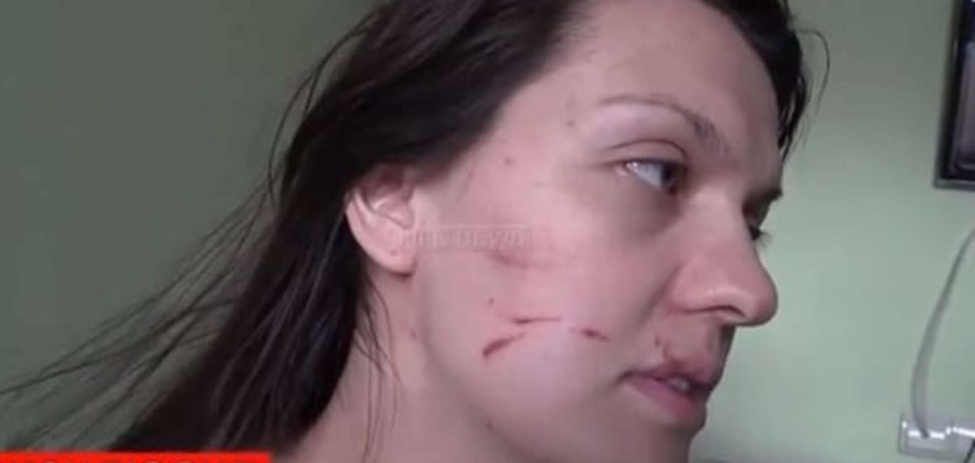 У Москві лікар жорстоко побила вагітну біженку з Донбасу: відеофакт