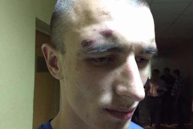 Задержанного под Радой бойца батальона 'Січ' били ради показаний — адвокат