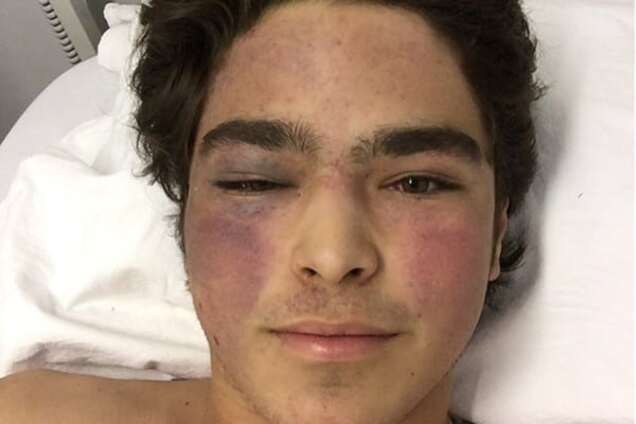 17-річний син легенди 'Формули-1' потрапив у найжорстокішу аварію: відео краху